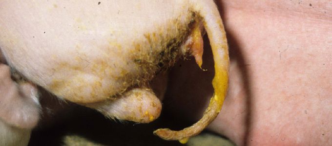 Treating E. coli in the Era of Prudent …